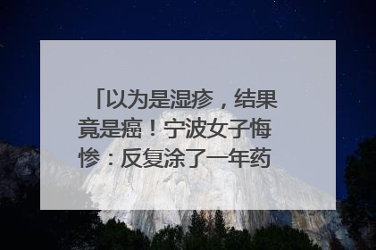 以为是湿疹，结果竟是癌！宁波女子悔惨：反复涂了一年药膏都没好！很多患者首诊都去了皮肤科